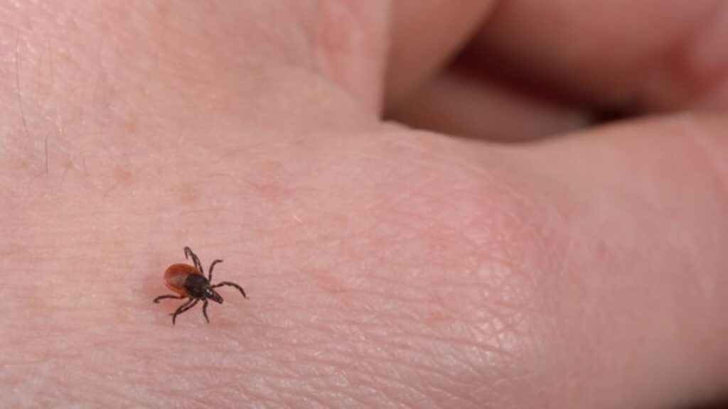 Tick season has arrived in Wisconsin Here’s how to protect yourself