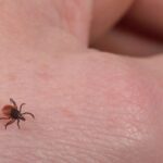 Tick season has arrived in Wisconsin: Here’s how to protect yourself from Lyme disease